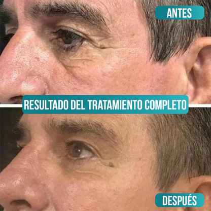 Crema Antiedad para Hombres - VezeMen [Vitamina C, Ácido Hialurónico + Niacinamida]
